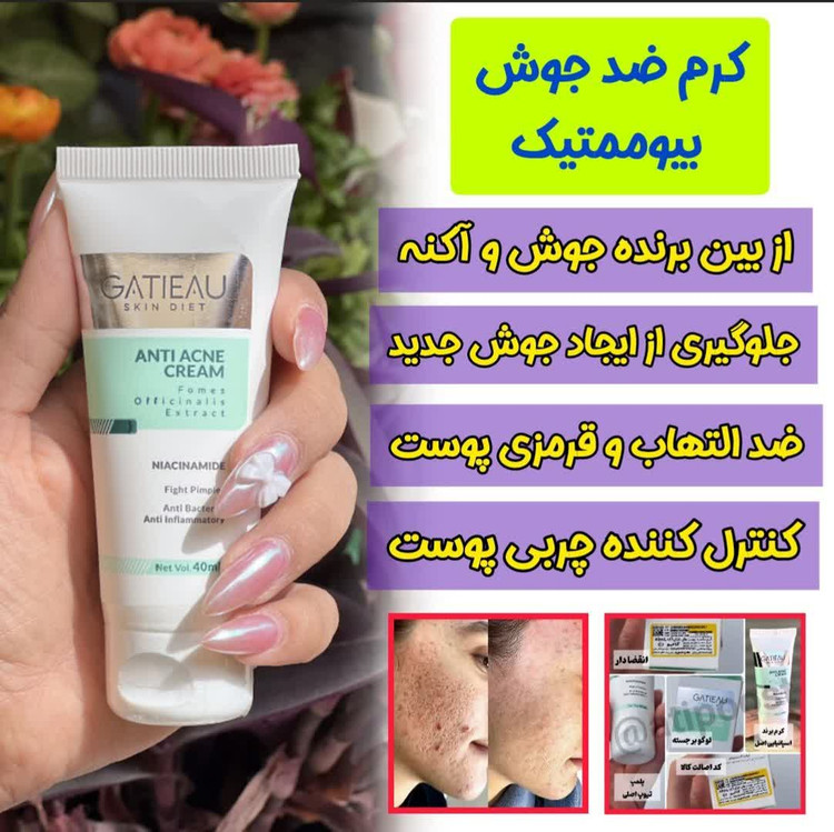 کرم بیومیمتیک ضد لک و جوش گاتیو | کمک به کاهش لک و جوش و بهبود ظاهر پوست | ساخت ایتالیا