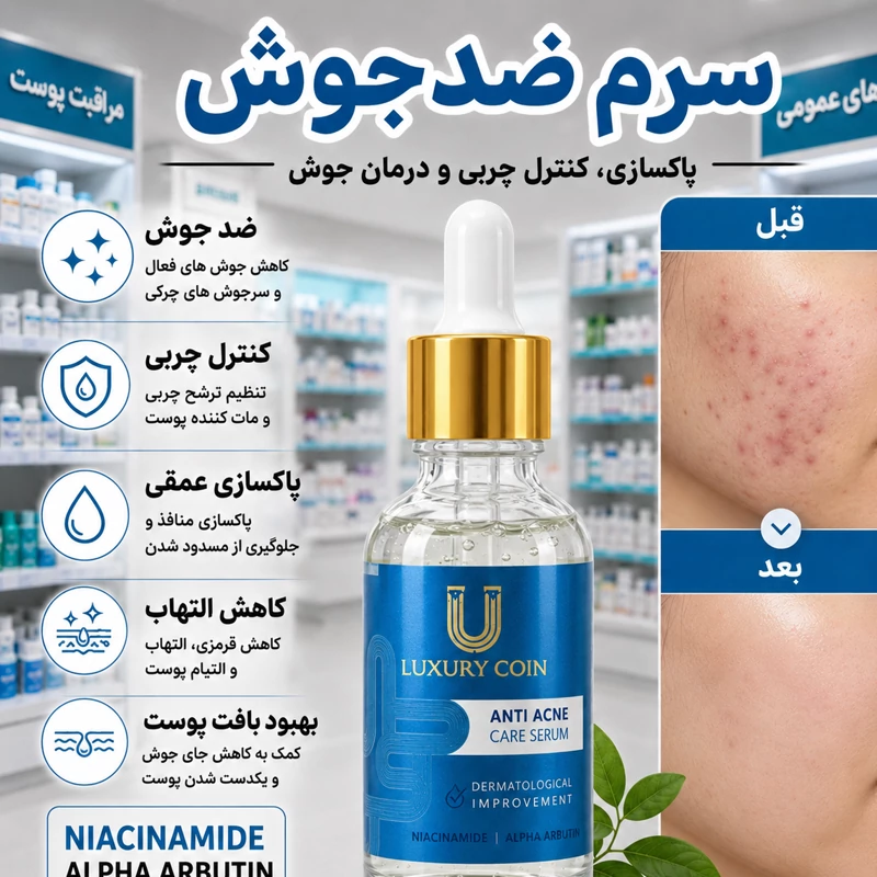 سرم لاکچری کوین اصل فرانسه برای جوش و آکنه | مراقبت از پوست مستعد جوش