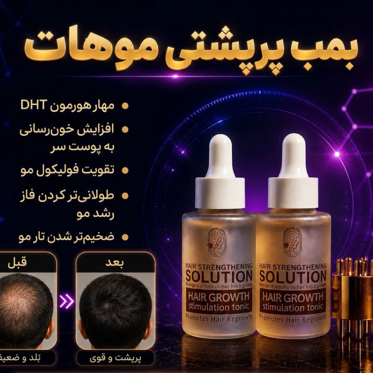 تونیک دوقلو اکسونیک تحت لیسانس آلمان با اپلیکاتور | تقویت و مراقبت از مو